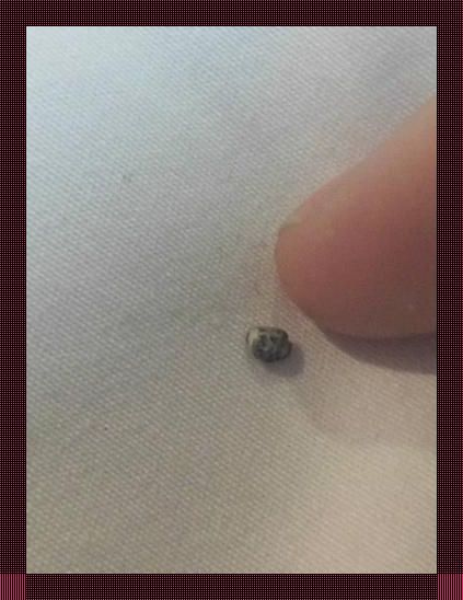 体内结石，幽默科技视角下的自我调侃