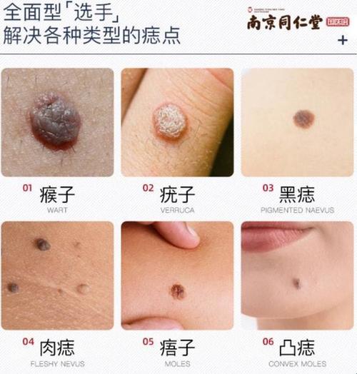 سرقكنۇva的区别，笑谈科技圈里的引爆话题