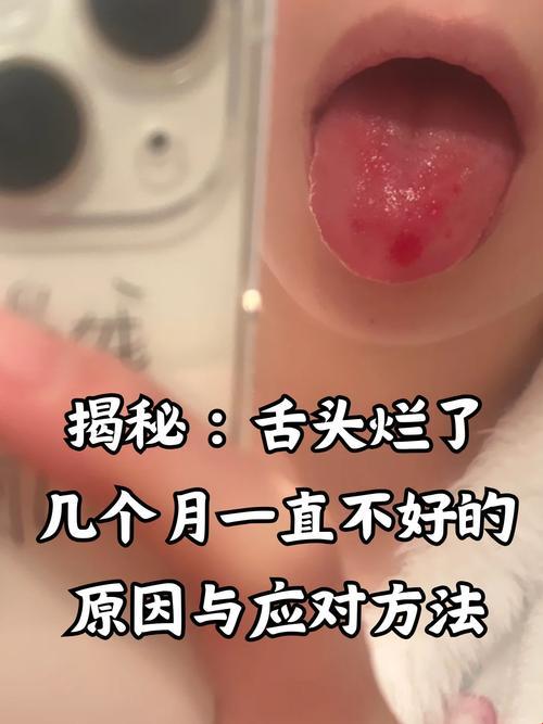 2025年口腔江湖新难题：舌头探洞太深怎么办？这些黑科技操作让网友直呼真香！