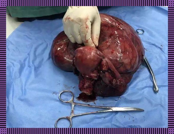 体内异物感,竟是新科技玩的惊喜?