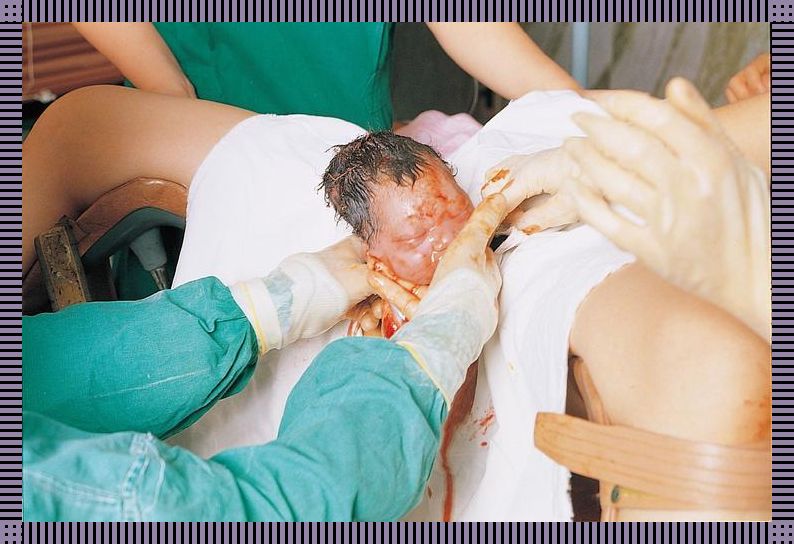 科技江湖,纯生急产胎头出,笑谈间引爆潮流