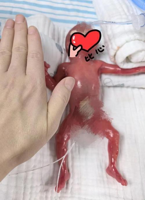 “微缩世界,潮流巅峰:探秘全球最小BB的诡异魅力”